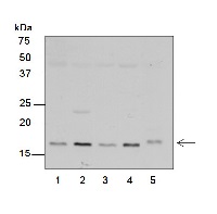 RPS7 | Ribosomal protein S7 (chloroplastic) in the group Antibodies Plant/Algal  / DNA/RNA/Cell Cycle / Translation at Agrisera AB (Antibodies for research) (AS15 2877)